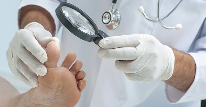 Дијагностички преглед на ноктите на нозете