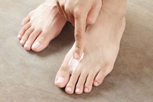 примена на маст од габата на кожата на нозете