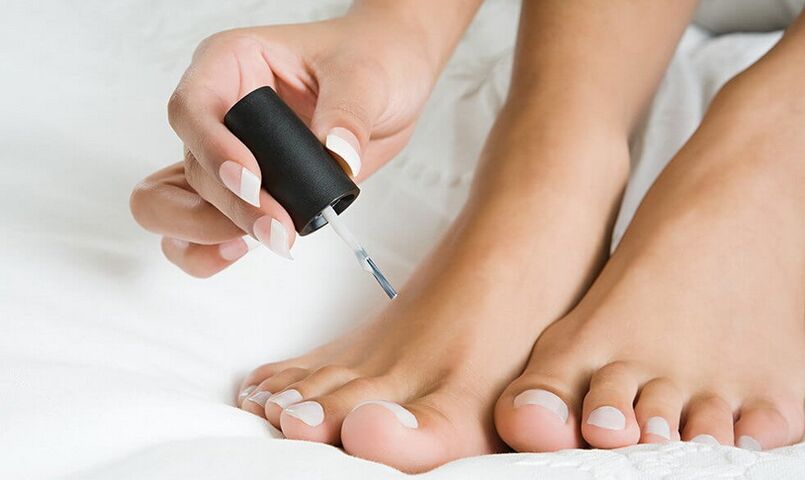 нанесување лак за лекување на габа на ноктите на нозете